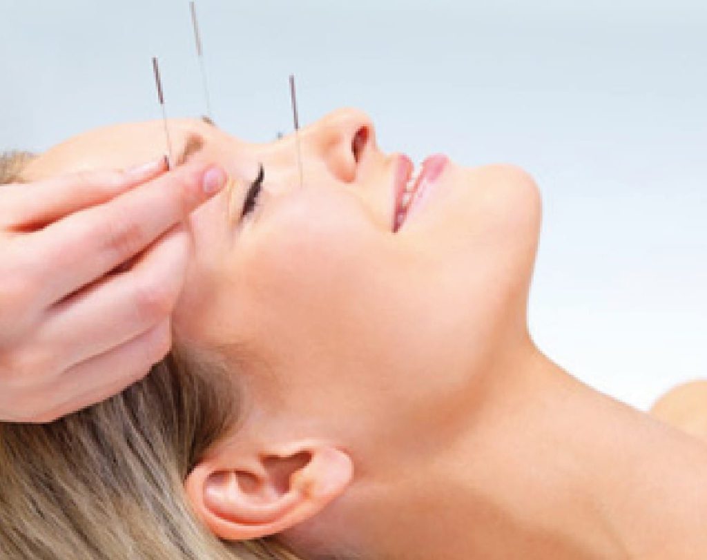 The art of acupuncture Hua Hin Today Your Premier Source for News